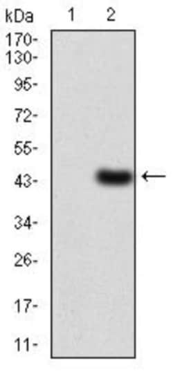 LDLR Antibody (1B10H10) - BSA Free, Novus Biologicals:Antibodies:Primary